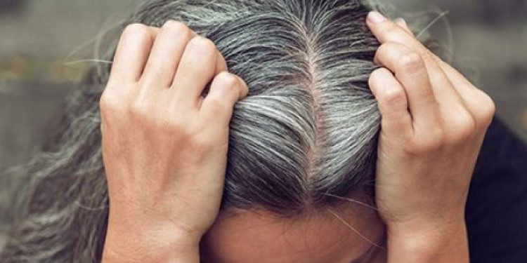 Rambut Beruban, Yuk Intip Cara Menghilangkan Uban Secara Alami